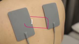 Accessory Pulse electrode patches [upl. by Adamsen247]