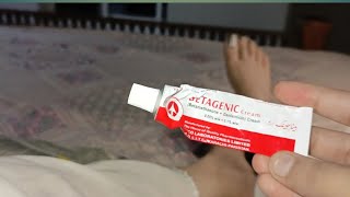 How to remove dark spots from feet 👣Betagenic cream no side effects 100 results [upl. by Marela]