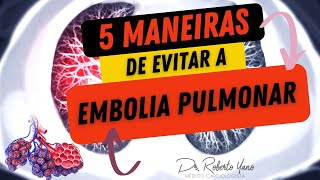 5 maneiras de evitar a Embolia Pulmonar Tromboembolismo pulmonar é grave [upl. by Ahsykal259]