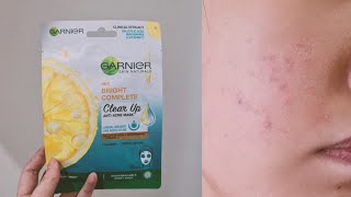 Garnier Bright Complete Clear Up Anti Acne Mask Review [upl. by Zile]