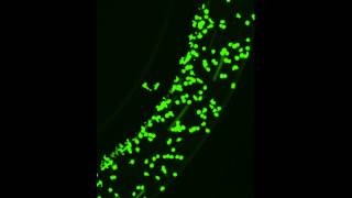 Realtime Leukocyte RollingAdhesionMigration Assay [upl. by Catlin]