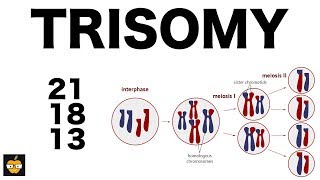 Trisomy 21 18 and 13 amp Nondisjunction Genetics [upl. by Helprin]