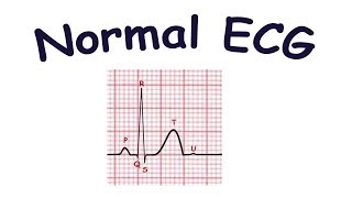 Normal ECG waves segments intervals [upl. by Ellainad]