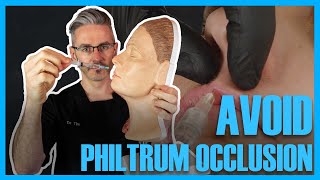 How To Reduce The Risk Of Occlusion In The Philtrum Columella Artery [upl. by Naej184]