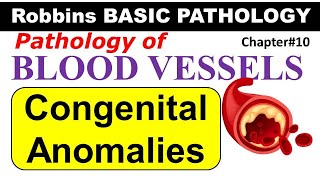 Ch12  Congenital Anomalies of Blood Vessels  Blood Vessel Pathology  Robbins Lectures [upl. by Attenweiler]