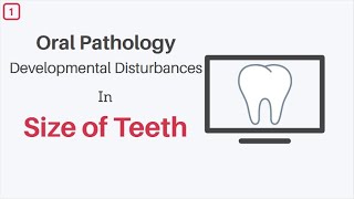 Developmental Disturbances in Size of Teeth Oral Pathology [upl. by Kylander]