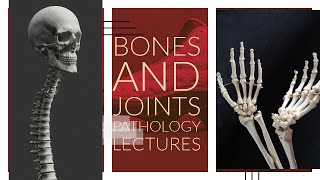 BONES AND JOINTS PATHOLOGY lecture 8 OSTEOSARCOMA important topic made easy [upl. by Tonkin]