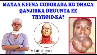 MAXAA KEENA CUDURADA KU DHACA QANJIDKA DHUUNTA EE THYROIDKA Hypo and Hyperthroidsm Dr faris [upl. by Victoria]