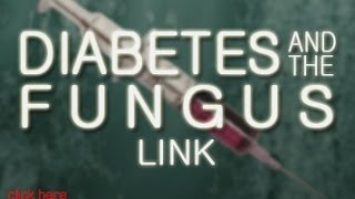 Diabetes  Know The Cause  With Doug Kaufmann [upl. by Aicire454]