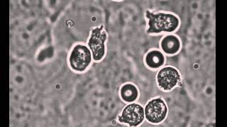 Neutrophil transmigration through activated HUVEC [upl. by Adnawyek]