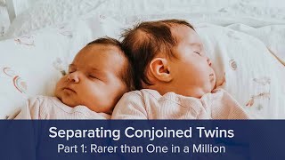 Separating Conjoined Twins Part 1 Rarer than One in a Million [upl. by Einwahs]