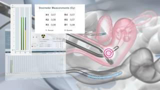 Eckert amp Ziegler BEBIG The SagiNova® Afterloader for HDR Brachytherapy [upl. by Ahsinwad]