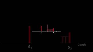 Mitral Valve Prolapse Heart Sound heart cardiology heartsounds [upl. by Micheline883]