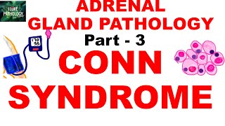 Adrenal Gland Pathology Part 3 HYPERALDOSTERONISM CONN SYNDROME [upl. by Care125]