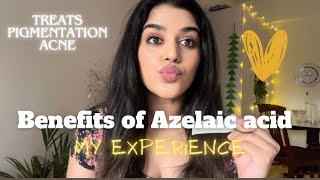 Benefits of Azelaic acid My experience with Azelaic acidAzelaic acid for acne amp Pigmentation acne [upl. by Aytnahs]