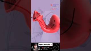 Brachytherapy cervical cancer shorts knowledge animation [upl. by Cosette253]