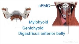 sEMG Biofeedback as an Adjunct in Dysphagia Therapy Video  Michael Crary  MedBridge [upl. by Ahsiekel]