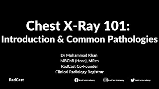 RadCast Academy Introduction To The Chest XRay amp Common Pathologies cxr radcast [upl. by Gothurd]