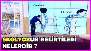 Skolyoz Nedir Nasıl Tedavi Edilir  Feridun Kunak Show  6 Mart 2019 [upl. by Brighton]