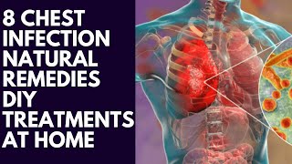 8 Alarming Chest Infection Symptoms Youre IGNORING chestinfection [upl. by Curry]