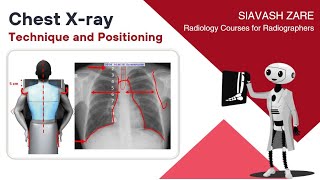 Chest Xray PA Technique and Positioning [upl. by Aicilec]