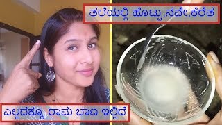 ಡ್ಯಾಂಡ್ರಫ್ ಹೋಮ್ ರೆಮಿಡೀಸ್ I Dandruff Home Remedies I Kannada Vlogs [upl. by Koser211]