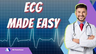 HIGH YIELD ECG Review for the USMLE AV Blocks [upl. by Mutua788]