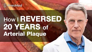 How I Reversed 20 years of Arterial Plaque [upl. by Eiffe]