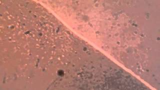 darting motility  Vibrio [upl. by Stevie]