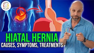 Understanding Hiatal Hernia causes symptoms diagnostic tests treatments [upl. by Dj]