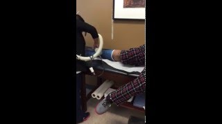 Ruptured Achilles tendon cast removal part 2 [upl. by Latterll]