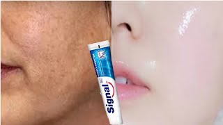 Utilisez du dentifrice pour éliminer la pigmentation et le mélasma et blanchir la peau [upl. by Rafiq]