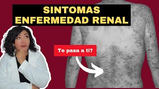 los PEORES signos de INSUFICIENCIA RENAL que no conoces ✋🏻🛑 [upl. by Flin]