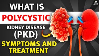 Polycystic Kidney Disease PKD ADPKD ARPKD Treatment Symptoms Causes [upl. by Landers397]