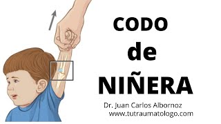 El codo de niñera cododeniñera nurseelbow shorts [upl. by Beisel877]