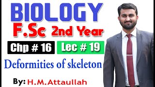 Deformities of skeleton  Chapter 16  2nd year Biology  Lec  19 [upl. by Yelram]