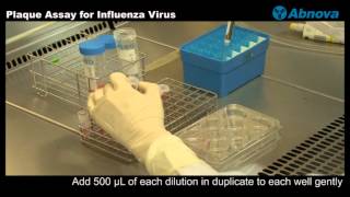 Plaque Assay for Influenza Virus [upl. by Bainbrudge]