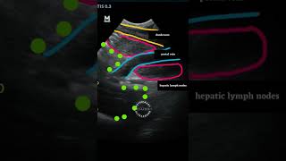 Hepatic lymph nodes [upl. by Germayne133]