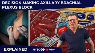 Axillary Block Decision Making Explained  Crash course with Dr Hadzic [upl. by Sibbie668]