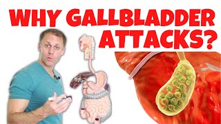 Understanding Gallbladder Attacks [upl. by Sherrill491]