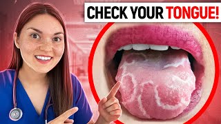 What your TONGUE says about your HEALTH Doctor Explains [upl. by Jaymee]