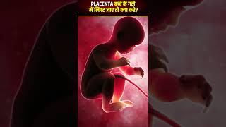 गर्भ में बच्चे के गले में placenta लिपट जाए तो क्या करे👼❗ [upl. by Bertila]