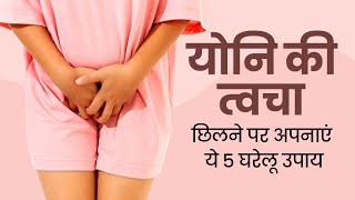 Natural Home Remedies to Get Rid from Itchy Private Parts  How to Treat Fungal Infections खुजली [upl. by Teuton]