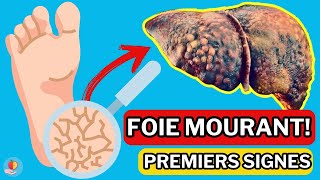 LE FOIE est en train de MOURIR 15 Signes étranges de DOMMAGES AU FOIE [upl. by Nilyad510]