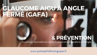 Glaucome aigu à angle fermé et sa prévention par iridotomie laser Pole ophtalmologique [upl. by Adnawot]