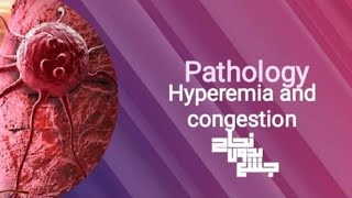 Hyperemia and congestionpathoL14 part 1 [upl. by Winifield]