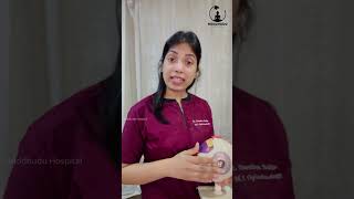 What is Pterygium  Dr Swetha Sajja  Buddhudu Hospital [upl. by Nnuahs]