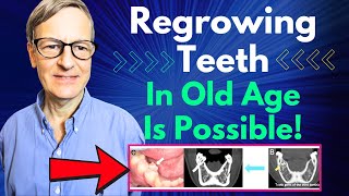 Regrowing Teeth In Old Age Is Possible Human Trial Starts This Year [upl. by Ehtyde]