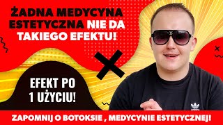 ROSSMANN❗️EFEKT JUŻ PO 1 UZYCIU❗️ Zapomnisz o BOTOKSIE MEDYCYNIE ESTETYCZNEJ I MASAŻACH TWARZY [upl. by Aihcropal]