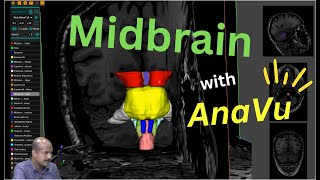 Overview of Midbrain  with AnaVU developed by IIITH with radiology input from SCTIMST [upl. by Oiramat360]